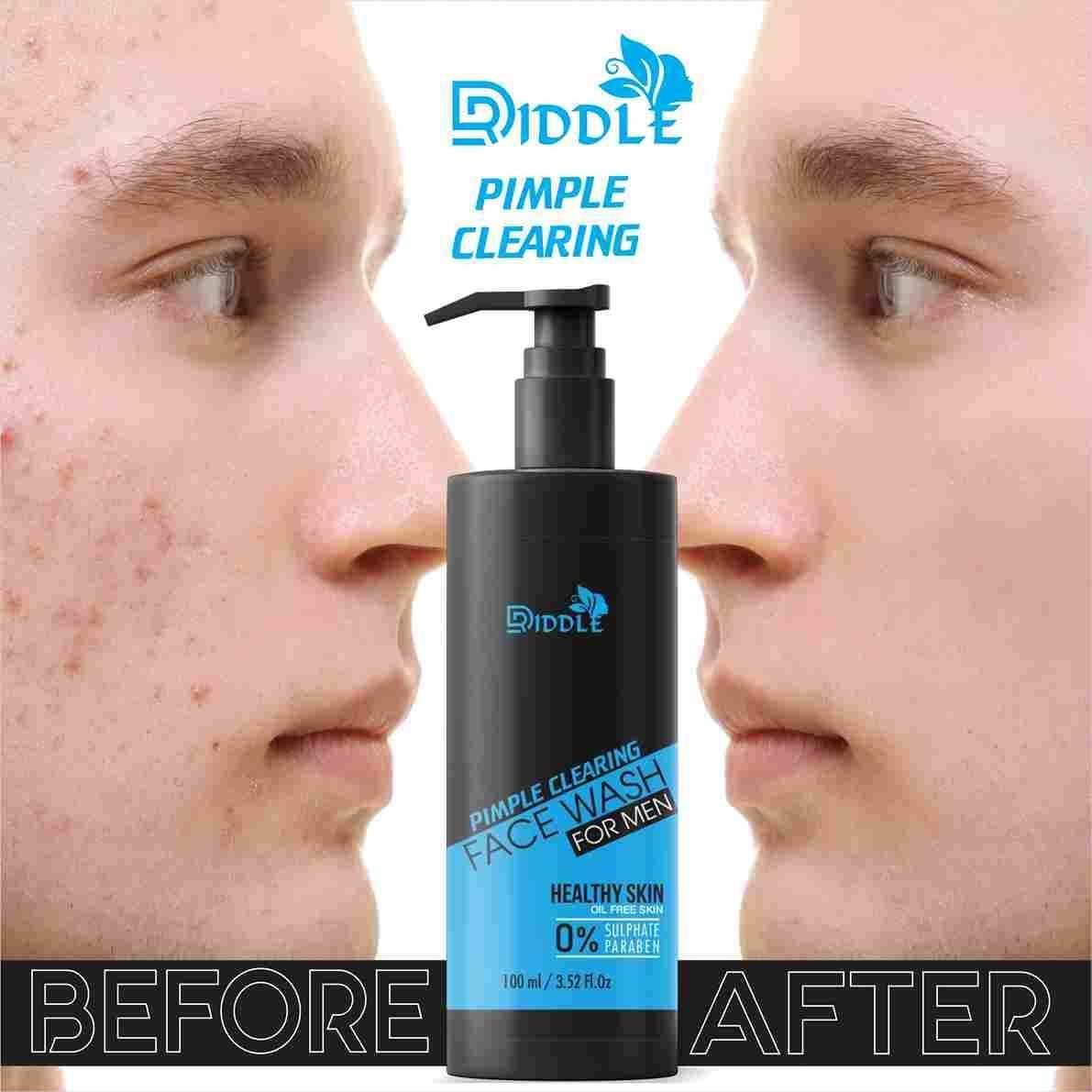 Pimple Clear Neem Face Wash 220 Gm