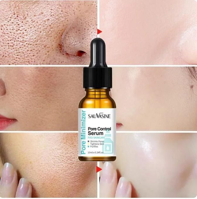Pore Shrinking Face Serum Remover Blackheads Dark Spots Acne Treatment Oil Control Moisturizing Improve Dull Smoothing Skin Care 30 ml (Pack of 2)